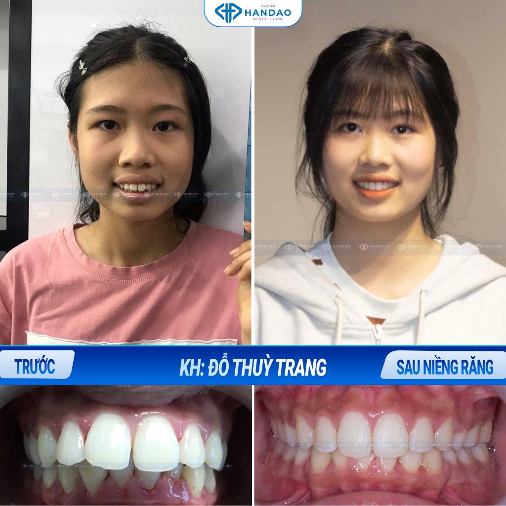 Bạn Đỗ Thùy Trang