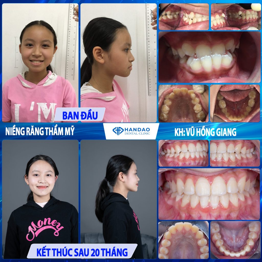Bạn Vũ Hồng Giang