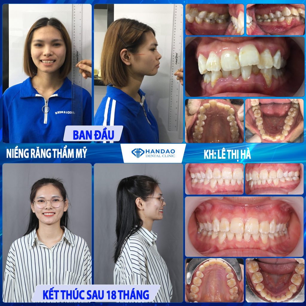 Bạn Lê Thị Hà