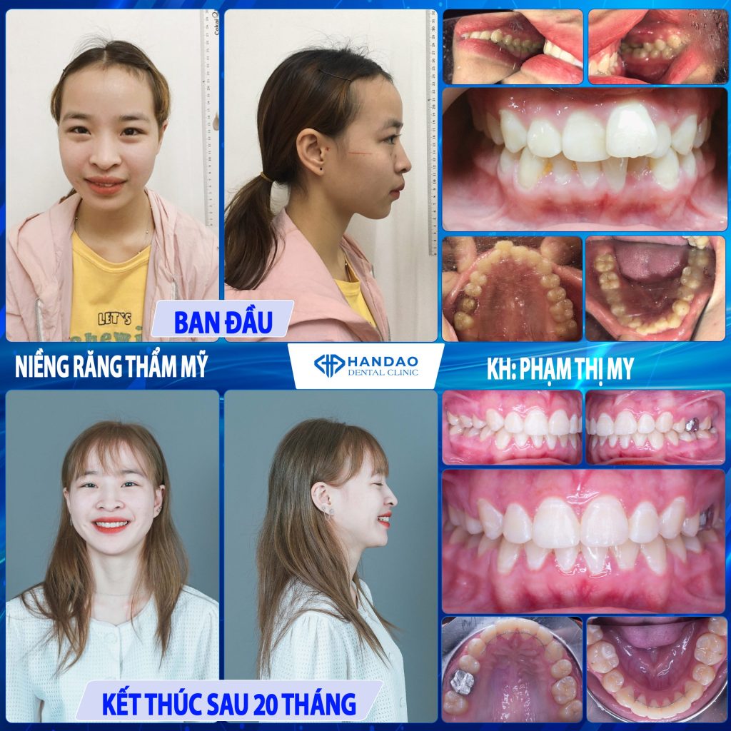 Bạn Phạm Thị My