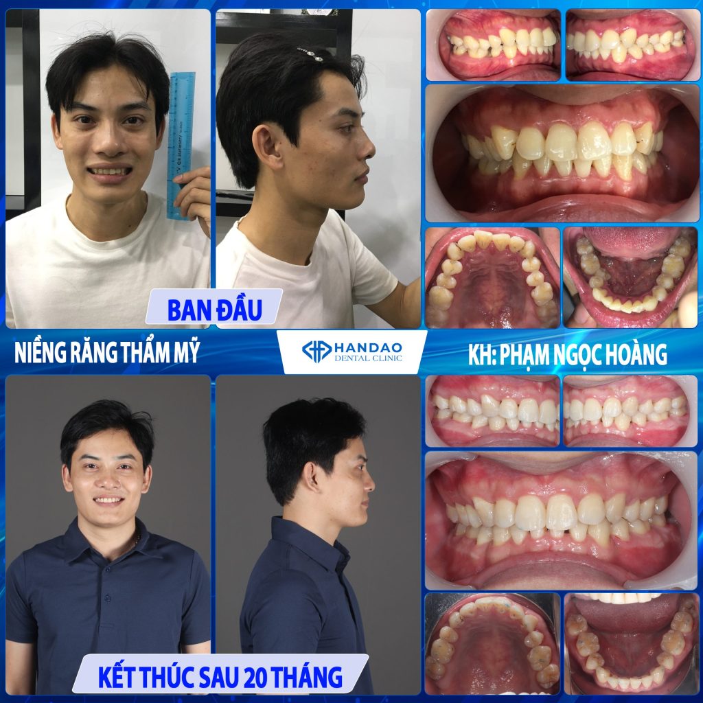 Bạn Phạm Ngọc Hoàng
