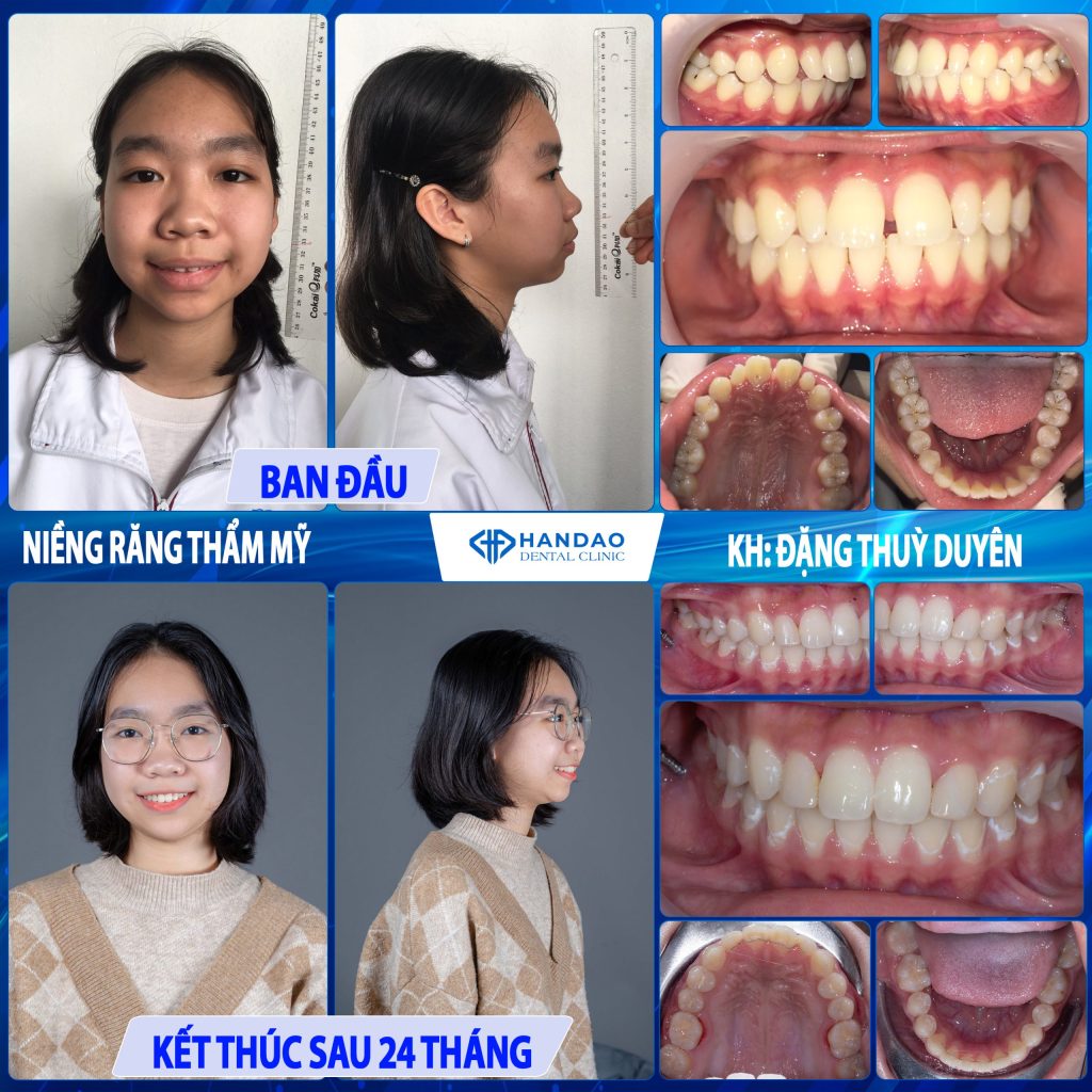 Bạn Đặng Thùy Duyên