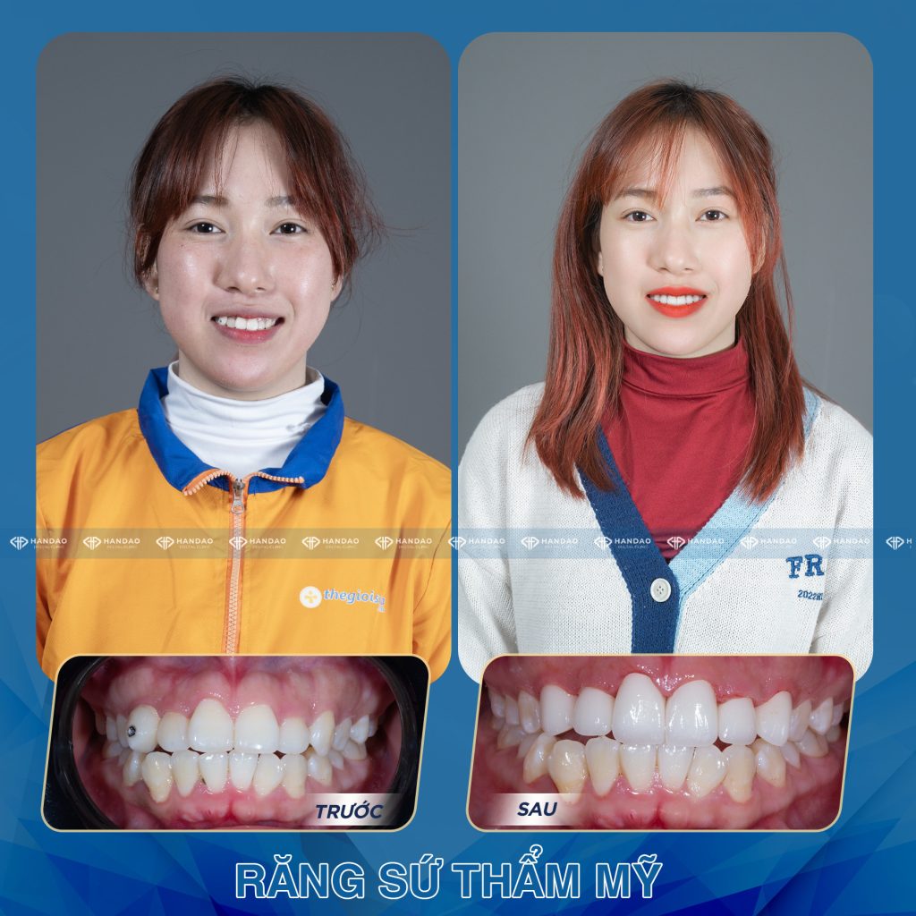 Bạn Ánh Tuyết