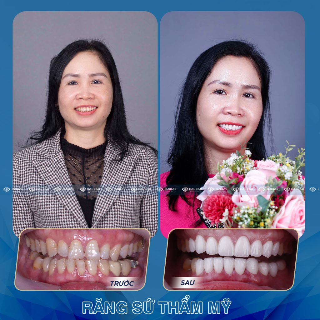 Chị Nhung