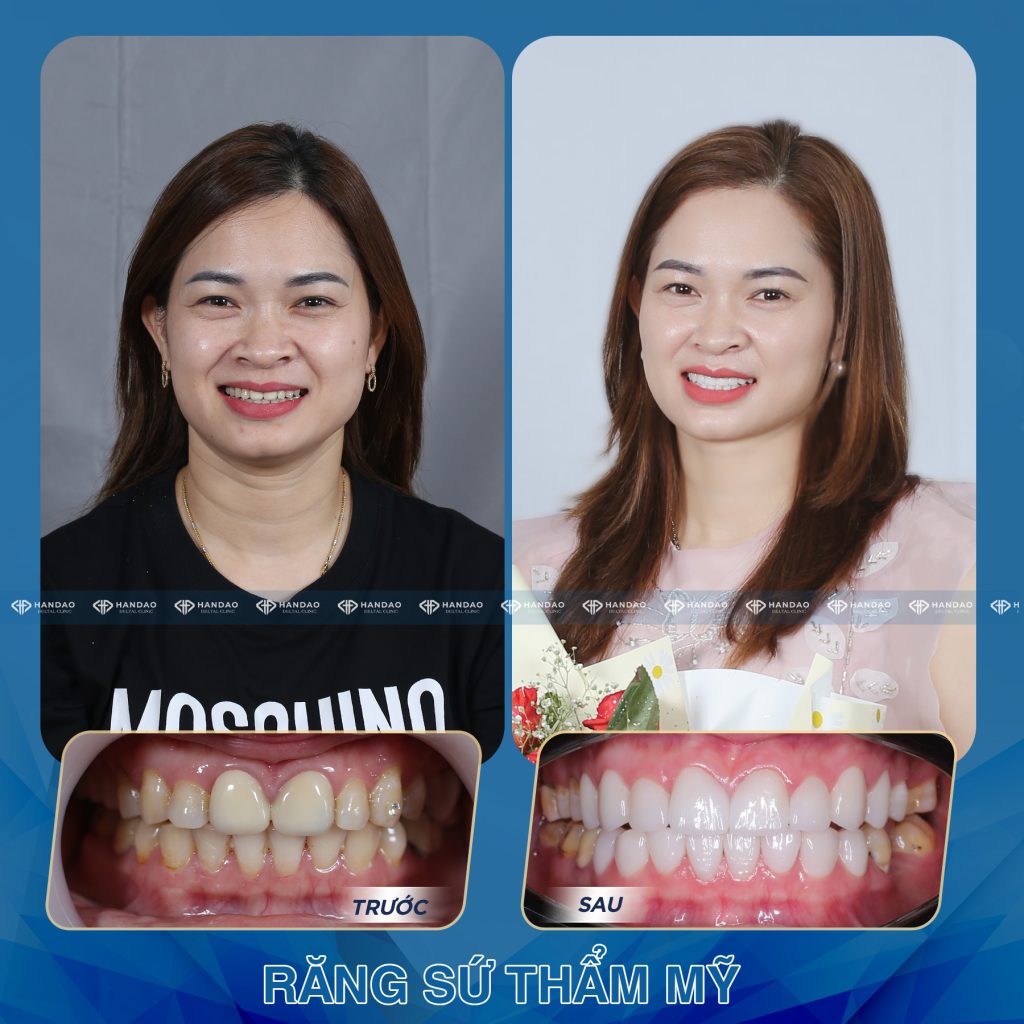 Chị Thúy