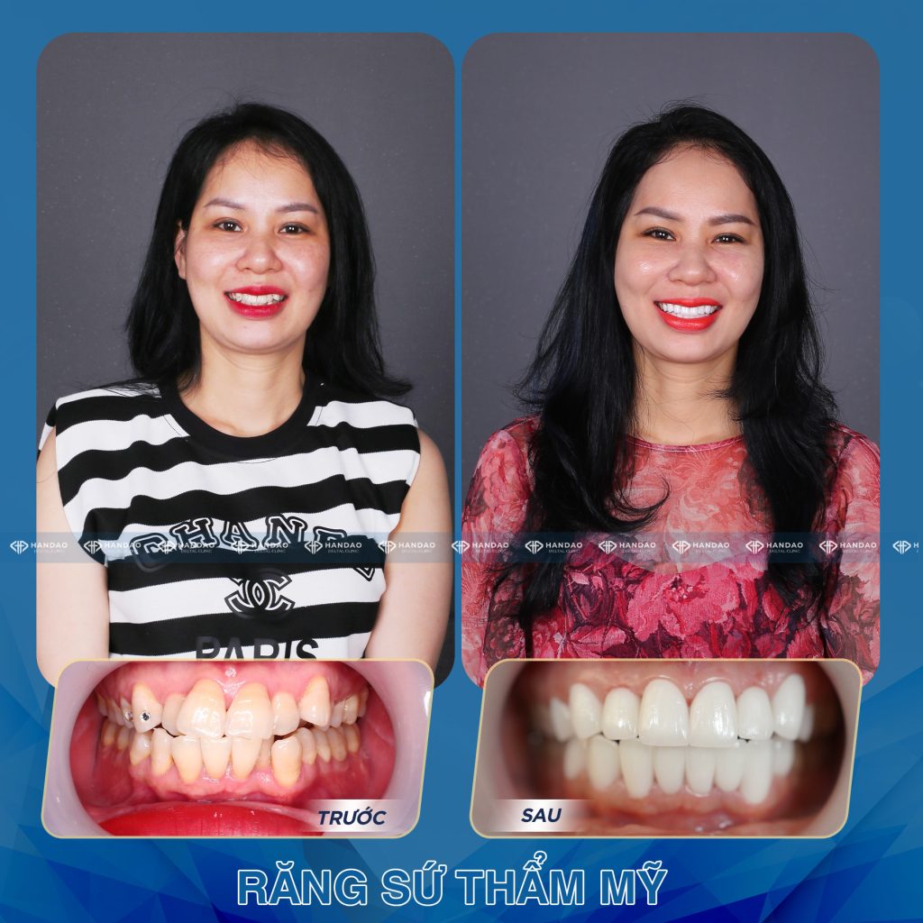 Chị Phương