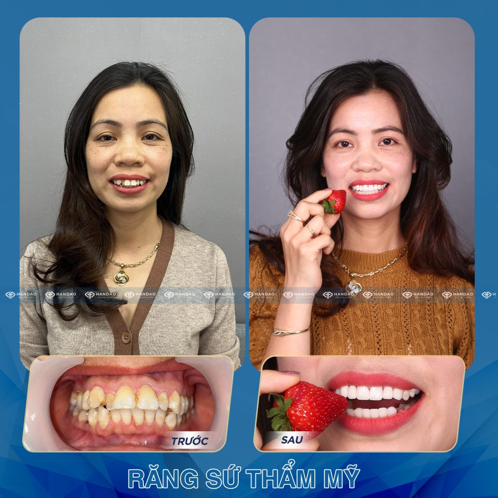 Chị Huyền