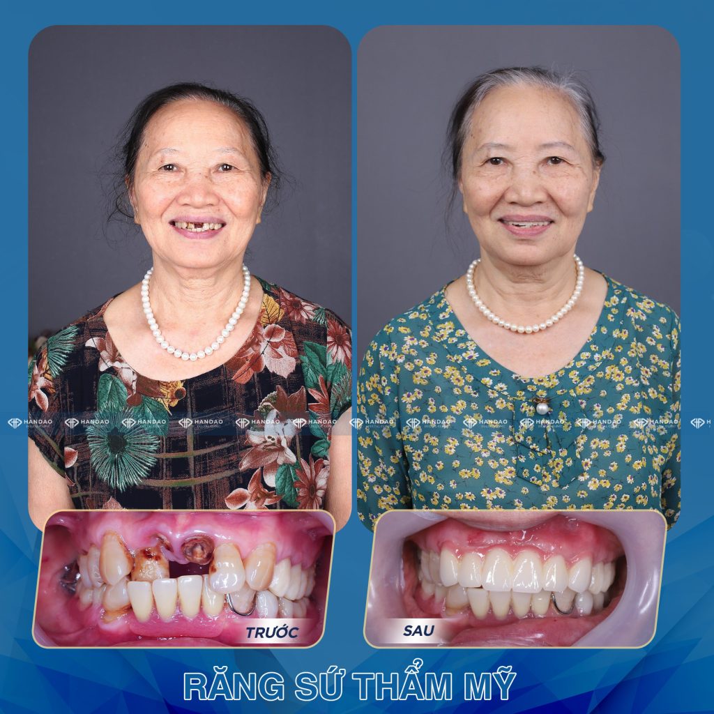 Bác Mỹ