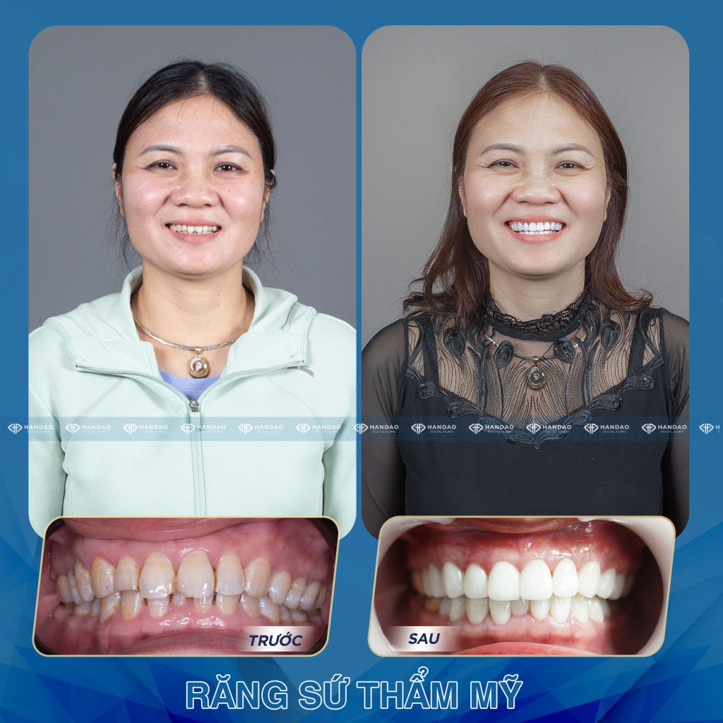 Cô Đinh Thị Nội