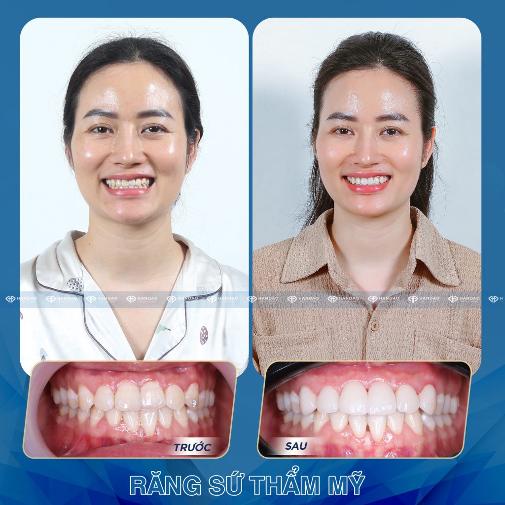 Chị Huyền