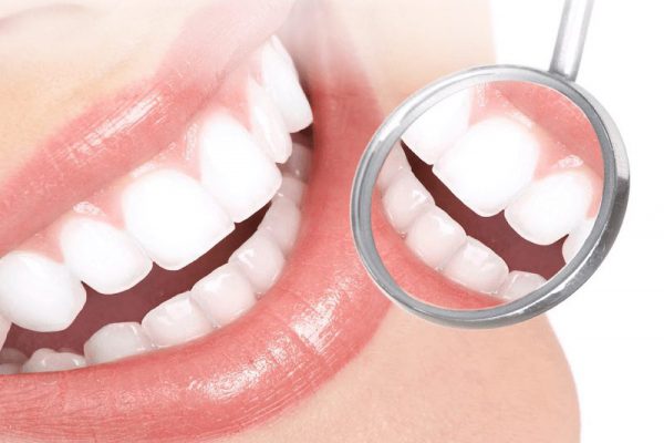 Bọc răng sứ Nam Định - nụ cười trắng đều, tự nhiên tại Nha khoa Hân Đào