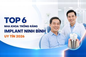 Top 6 nha khoa trồng răng Implant Ninh Bình uy tín 2026 - Nha khoa Hân Đào