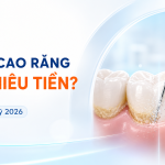 Giá lấy cao răng tại Nha khoa Hân Đào