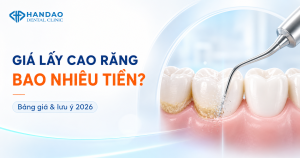 Giá lấy cao răng tại Nha khoa Hân Đào