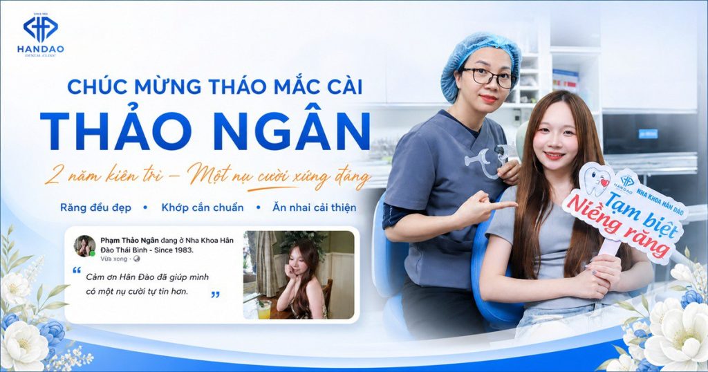 Niềng răng mắc cài - bạn Thảo Ngân tháo niềng tại Nha khoa Hân Đào