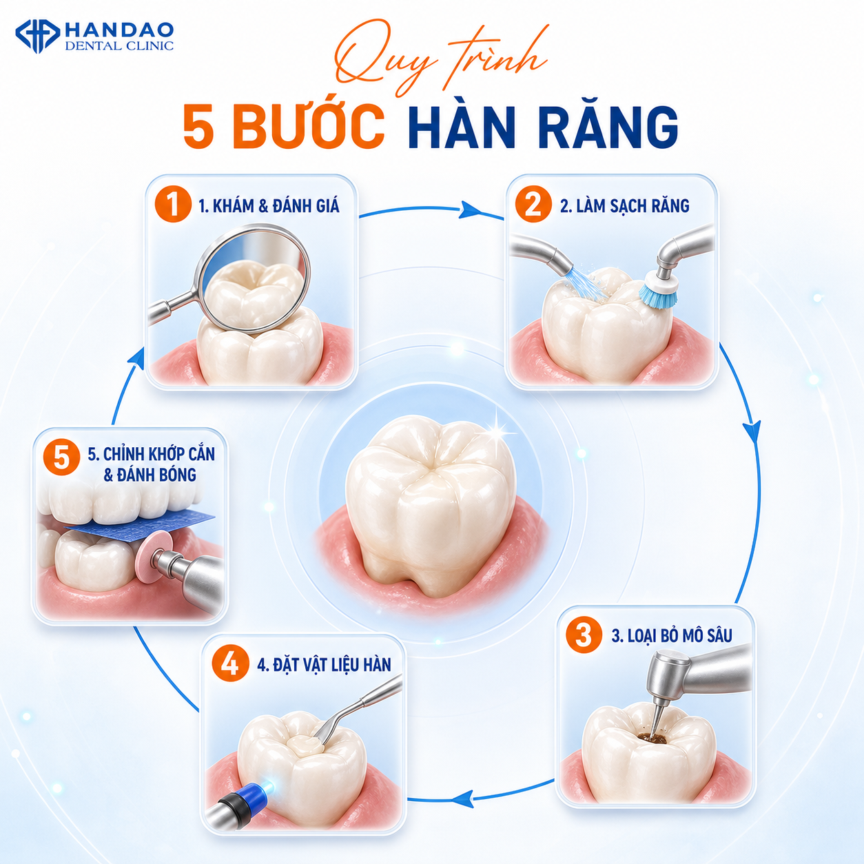 Quy trình hàn răng tại Nha khoa Hân Đào