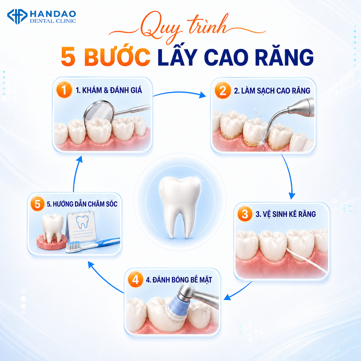 Quy trình lấy cao răng tại Nha khoa Hân Đào