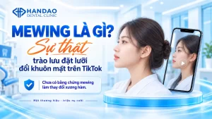 Mewing là gì - trào lưu đặt lưỡi trên TikTok - Nha khoa Hân Đào
