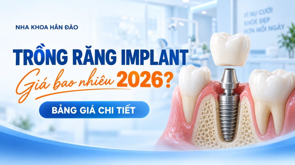 Bảng giá trồng răng Implant 2026 tại Nha khoa Hân Đào