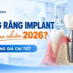 Bảng giá trồng răng Implant 2026 tại Nha khoa Hân Đào