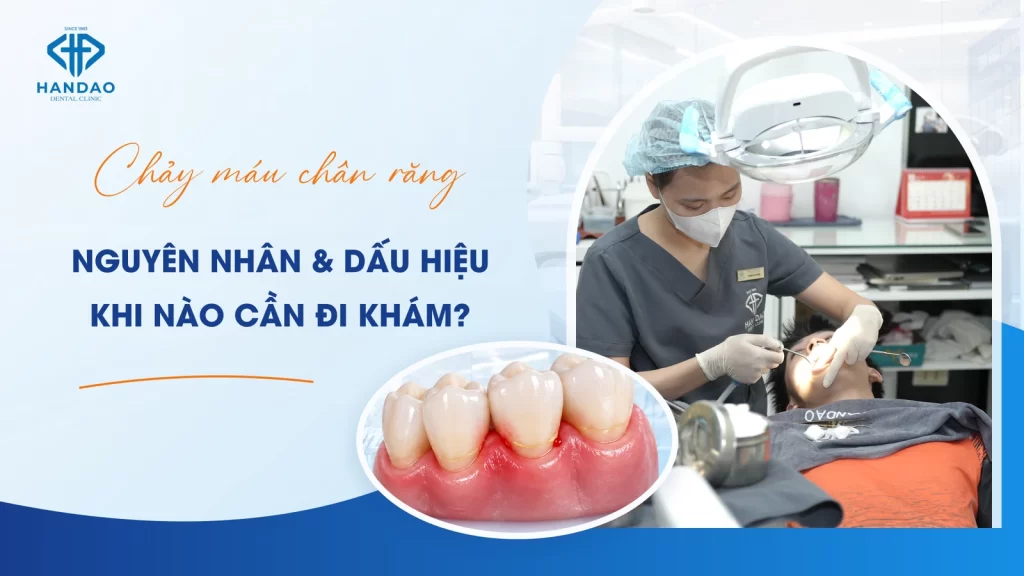 Chay mau chan rang khi danh rang - dau hieu viem nuou