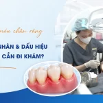 Chay mau chan rang khi danh rang - dau hieu viem nuou