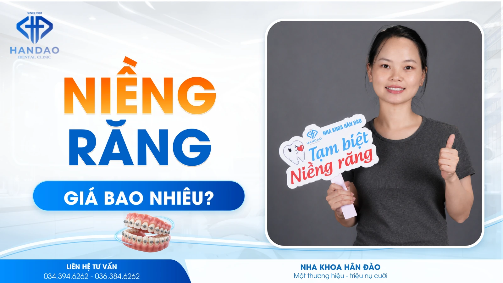 Niềng răng giá bao nhiêu? Bảng giá chi tiết 2026
