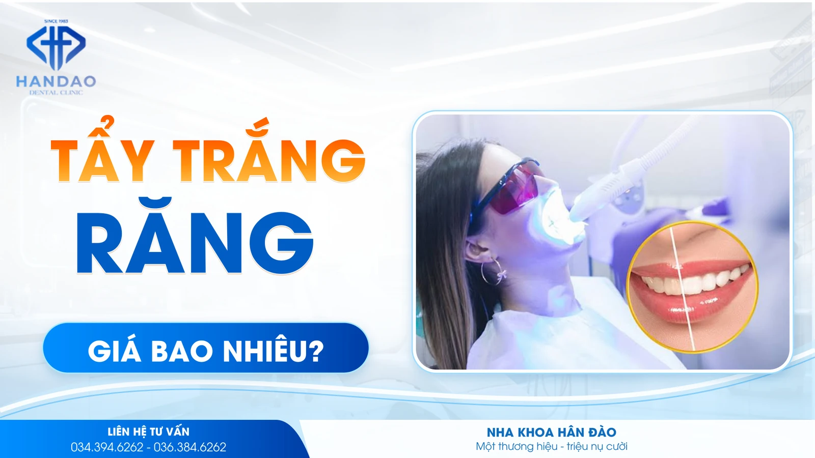 Tẩy trắng răng giá bao nhiêu? Bảng giá & lưu ý 2026