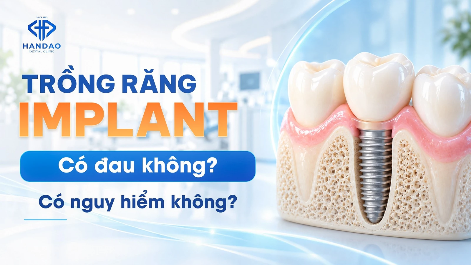 Trồng răng Implant có đau không? Có nguy hiểm không? (2026)